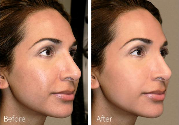 blood about I've acknowledged Laser frakcyjny - zabiegi laserowe Bielsko-Biała Aneta Ptak Instytut Anti Aging blood about I've acknowledged Laser frakcyjny - zabiegi laserowe Bielsko-Biała Aneta Ptak Instytut Anti Aging